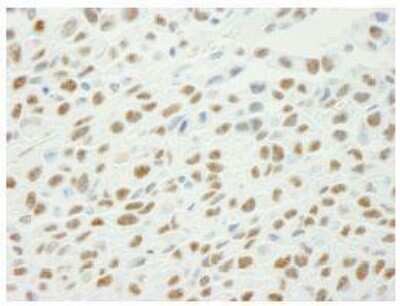 Immunohistochemistry-Paraffin: XRCC1 [p Ser461] Antibody [NB100-533]